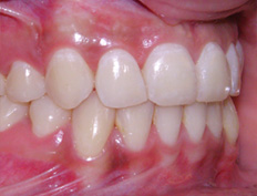 Gallery Image #93 - images/before-after-cycle/after-02.jpg