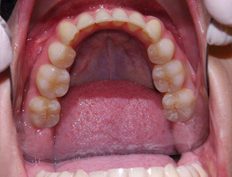 Gallery Image #96 - images/before-after-cycle/after-05.jpg