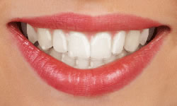 Gallery Image #132 - images/types-of-braces/invisalign.jpg